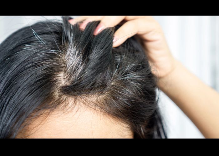 Bald Spot Blur Hair Style What It is and Why You Ought to Attempt It